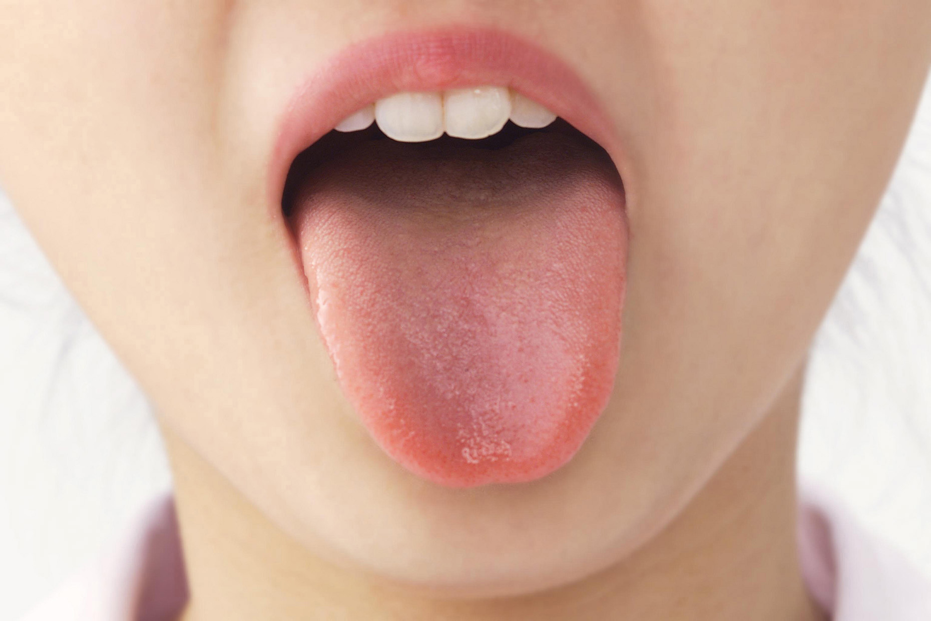 舌の癖